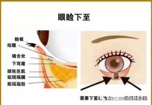 【疑惑分析】我这种情况是梅杰综合征吗？